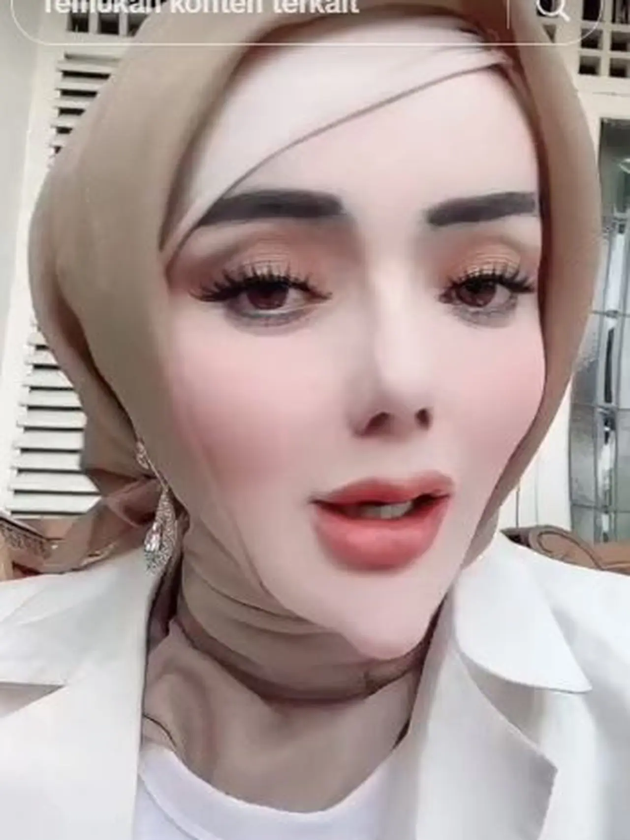 Potret Terkini Yuni Jasmine PNS Lampung Yang Viral Karena Dagunya Makin Lancip Hot Liputan