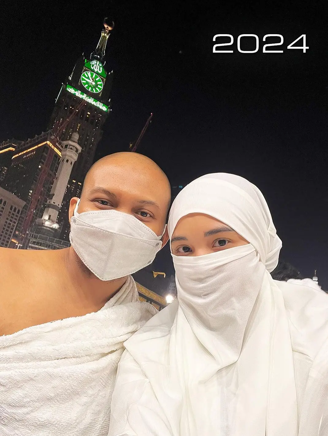 Potret Babe Cabita Pamer Kepala Plontos Saat Umrah Bikin Pangling