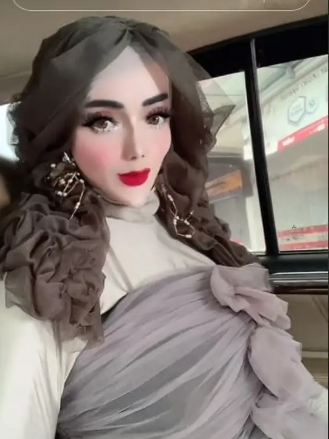 Potret Terkini Yuni Jasmine PNS Lampung Yang Viral Karena Dagunya Makin Lancip Page Hot
