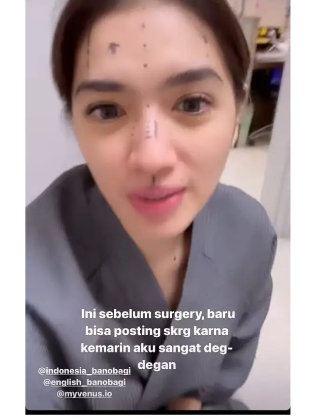 8 Potret Angel Karamoy Jalani Operasi Plastik di Korea Selatan, Curi Perhatian
