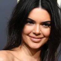 Kendall Jenner dengan wajah berjerawat. (marca.com)