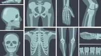ilustrasi tulang di tubuh manusia (freepik.com)