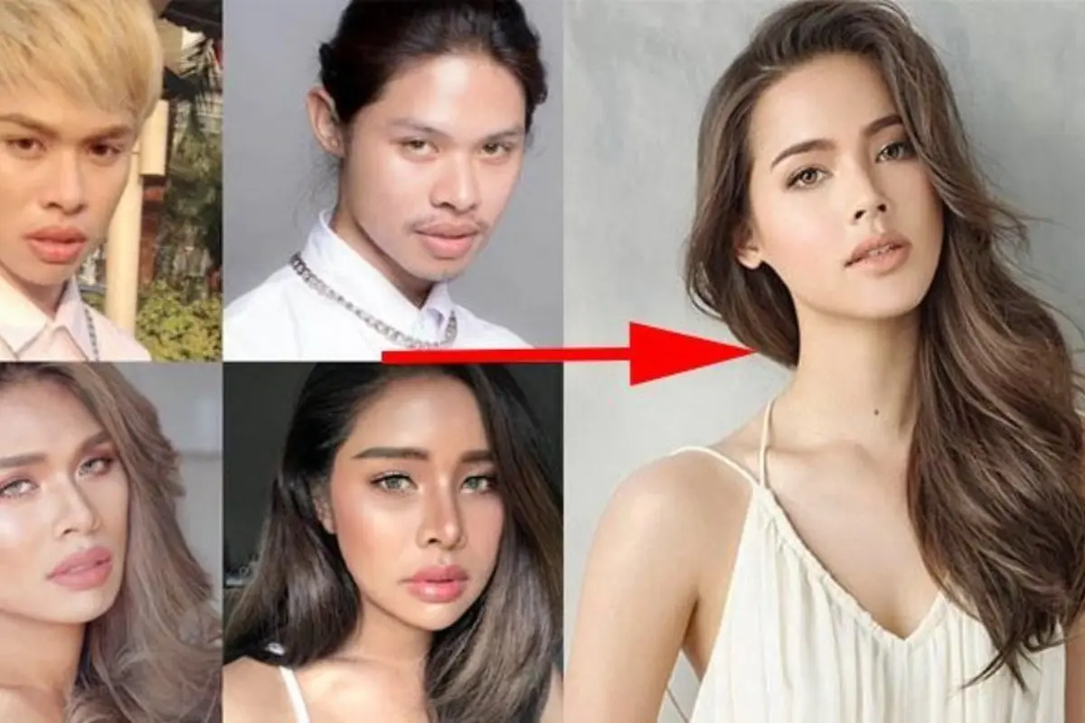 [Bintang] Demi Mirip Idola, Pria Ini Operasi Plastik dan Kelamin, Hasilnya Bikin Bengong