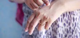 Kulit kering dan dehidrasi sama-sama dapat membuat wajah terasa tidak nyaman. Kenali perbedaan keduanya agar perawatan yang dilakukan lebih sesuai dengan kebutuhan kulit. (Foto/Dok: Pexels)