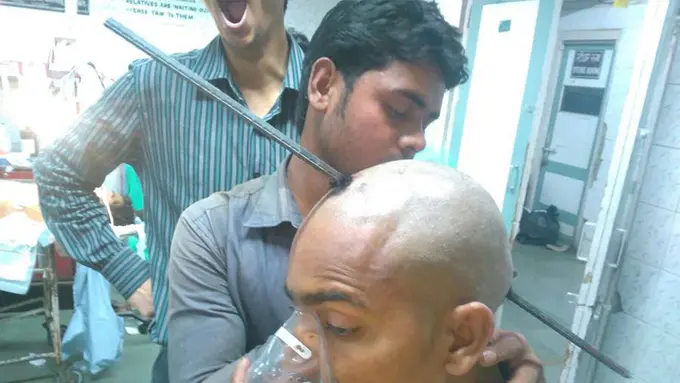 Kepala Tertancap Besi, Nyawa Pria Ini Berhasil Diselamatkan!