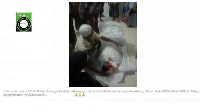 Ragam Hoaks Jenazah Pasien Covid 19 Organ Tubuh Dijual Hingga Tanpa Bola Mata Cek Fakta Liputan6 Com