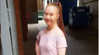 Madeline Stuart, model yang dikenal dengan penyakit Down Syndrome yang dideritanya. (dok. Instagram @madelinesmodelling_/https://www.instagram.com/p/BoTrmAnABWG/Esther Novita Inochi)