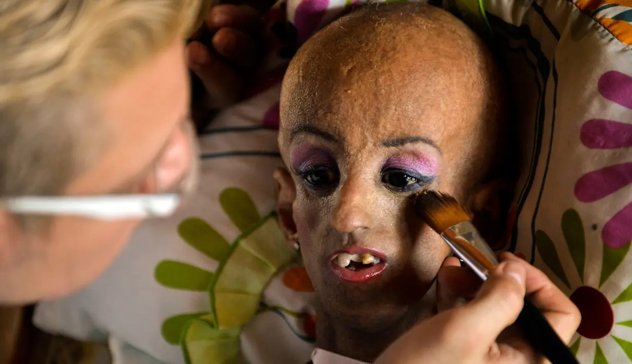 Magali Gonzalez Sierra dirias sebelum perayaan ulang tahunnya ke-15 di El Cabuyal, Kolombia, 16 Januari 2016. Magali menderita progeria, kelainan genetik yang membuat tubuhnya cepat tua hingga memiliki tubuh setara wanita usia 90 tahun. (AFP/LUIS ROBAYO)