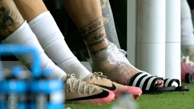 Foto: Penampakan Kaki Bengkak Lionel Messi di Final Copa America 2024