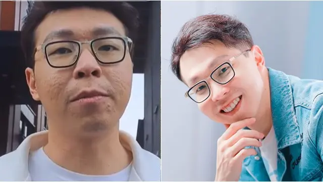 Potret Wajah 6 Artis Ini Jadi 'Korban' Kamera Wartawan, Perbedaannya Disorot
