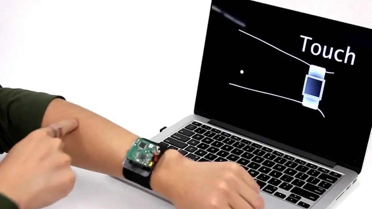 Smartwatch