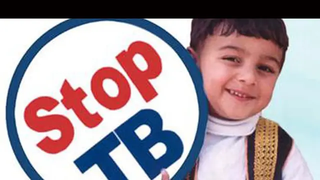 TBC