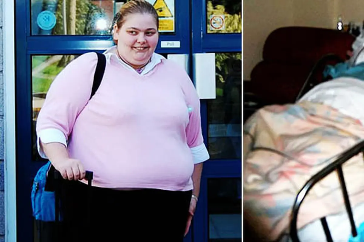 Beth sebelum operasi | Foto: Dailymail.co.uk