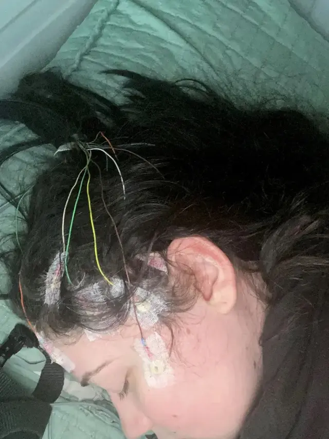 Wanita Alergi Gravitasi