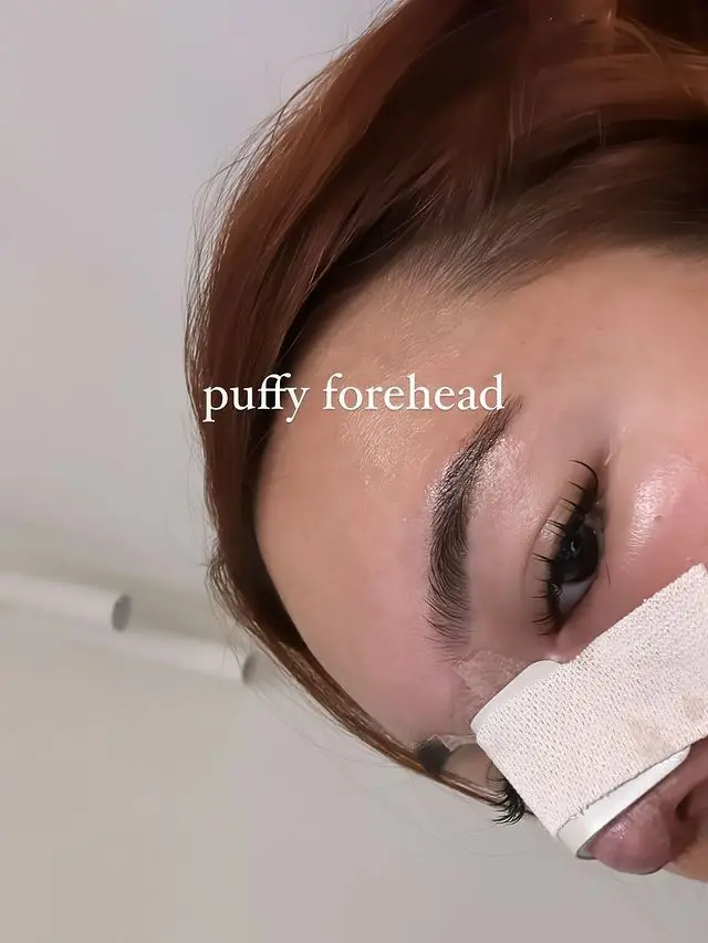 7 Potret Shafa Harris yang Jalani Operasi Plastik pada Hidung di Korea Selatan
