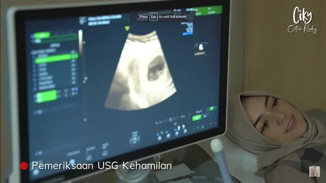 Momen Gemas Rezky Aditya dan Citra Kirana Datang ke Dokter Kandungan