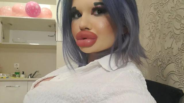 Ingin Tampil Bak Boneka, Wanita Akan Injeksi Bibir Ke 27 Kali Akhir Tahun Ini