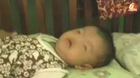 [VIDEO] Bayi Sri, 3 Bulan Hidup Tanpa Hidung