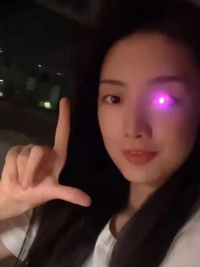 Buta Karena Kecelakaan, Mata Wanita Ini Bisa Berubah Warna Bak Robot