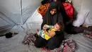 Kelaparan akut yang terjadi Gaza, Palestina, akibat blokade bantuan dan serangan militer Israel. (Omar AL-QATTAA/AFP)