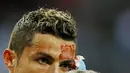 Striker Real Madrid, Cristiano Ronaldo, mengalami pendarahan di bagian pelipis saat melawan Deportivo La Coruna pada laga La Liga di Stadion Santiago Bernabeu, Minggu (21/1/2018). Real Madrid menang 7-1 atas Deportivo La Coruna. (AP/Francisco Seco)