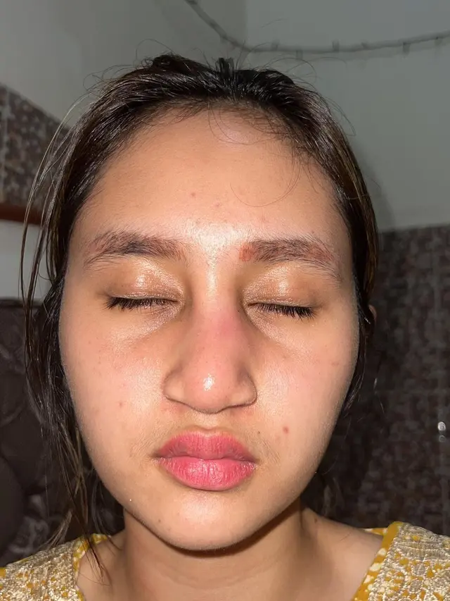 6 Potret Kronologi Dhyaz Anak Farida Nurhan Alami Infeksi Hidung Pasca Implan