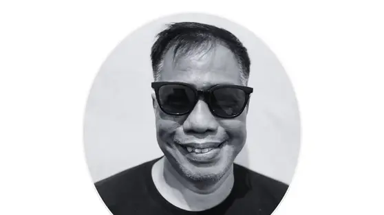 Temon Meninggal karena Serangan Jantung, Abdel Ucapkan Selamat Jalan