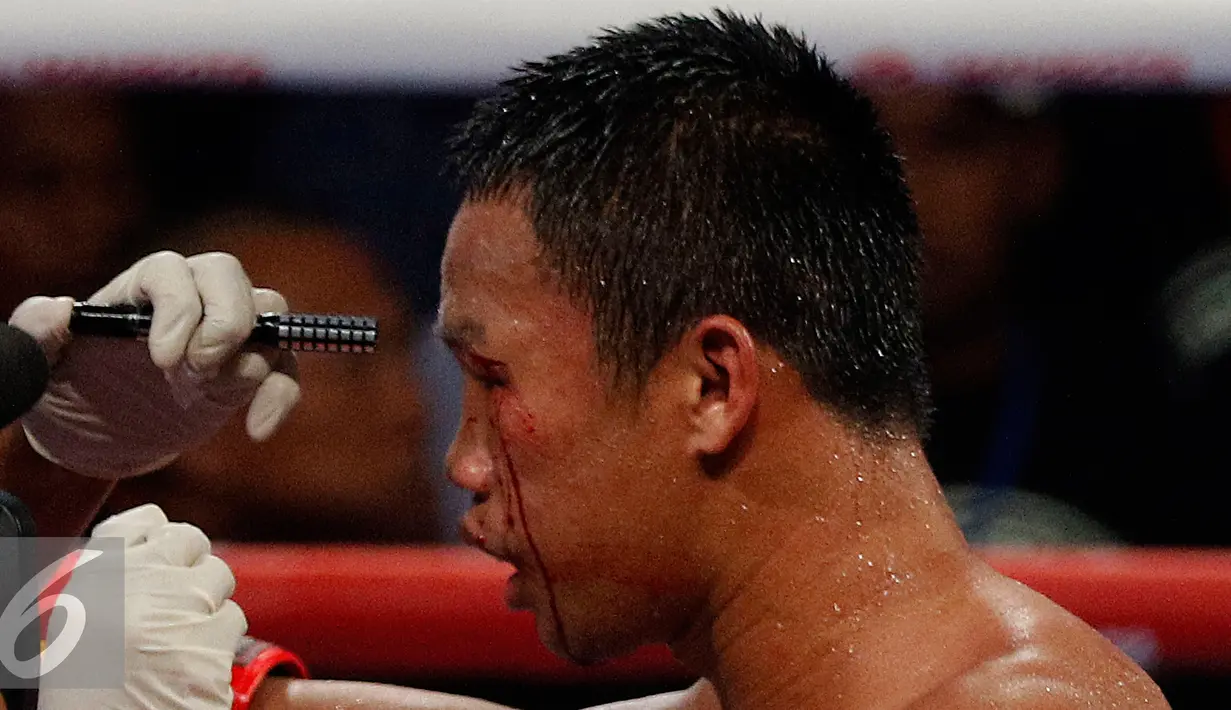 Petinju Indonesia Daud Yordan mendapat perawatan saat bertanding melawan Petinju Jepang Yoshitaka Kato pada Road to the World Champions di Balai Sarbini, Jakarta, Jumat (5/2). (Liputan6.com/Johan Tallo)