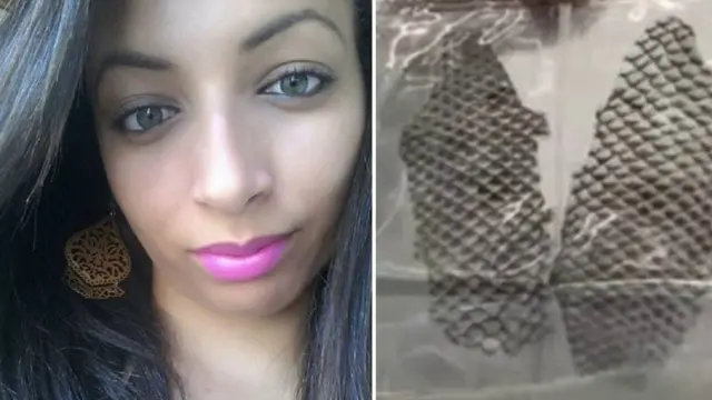 Alami Kelainan, Gadis Ini Berhasil Bikin Vaginanya Dengan Kulit Ikan