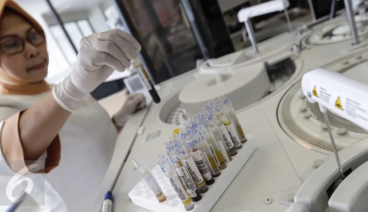 Seorang teknisi kesehatan akan melakukan pemeriksaan serum laboratorium kesehatan Rumah Sakit Husada, Jakarta, Rabu (08/2). (Fery Pradolo/Liputan6.com)