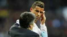 Striker Real Madrid, Cristiano Ronaldo, mengalami pendarahan di bagian pelipis saat melawan Deportivo La Coruna pada laga La Liga di Stadion Santiago Bernabeu, Minggu (21/1/2018). Real Madrid menang 7-1 atas Deportivo La Coruna. (AP/Francisco Seco)