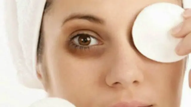 3 Cara yang Tak Terfikirkan untuk Hilangkan Kantung Mata Hitam