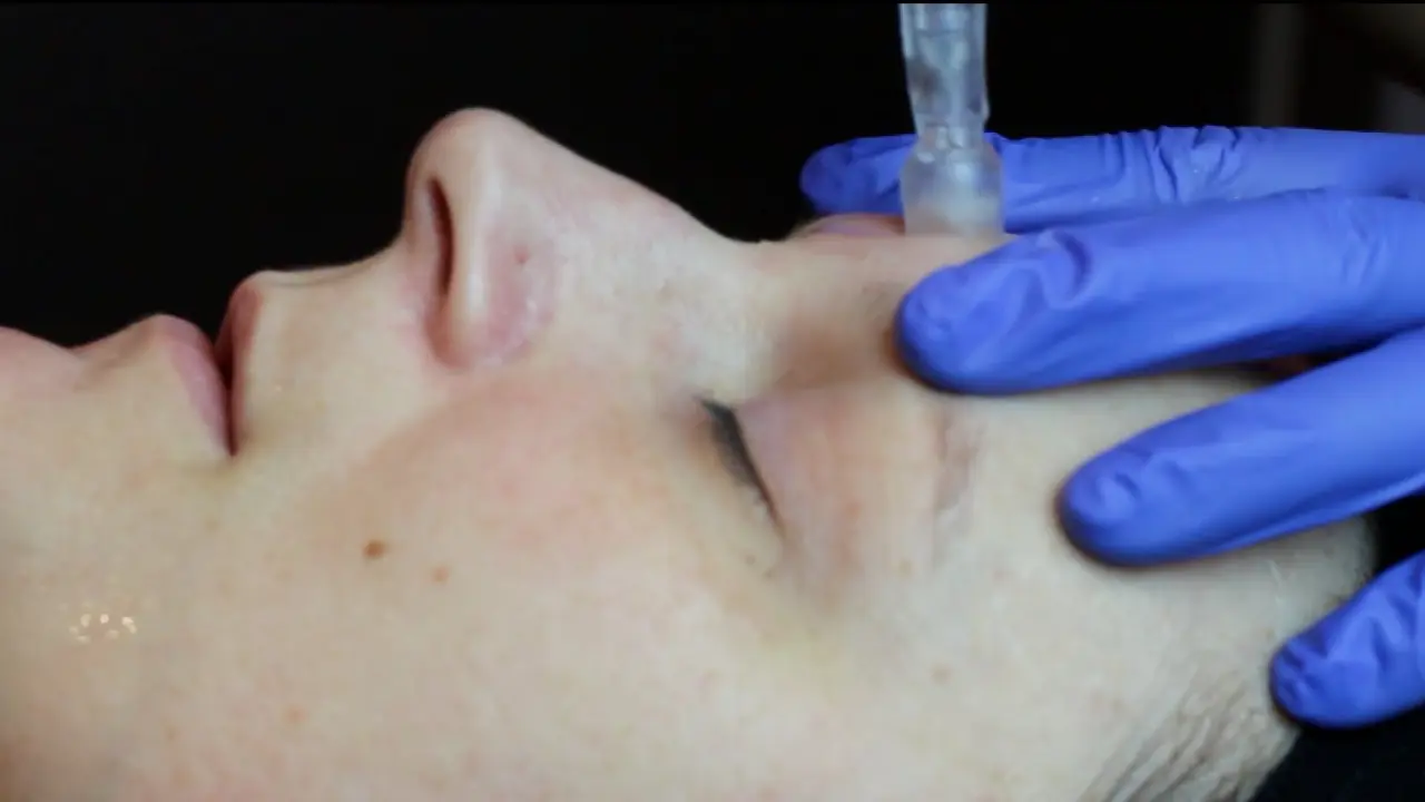 Dermastamp