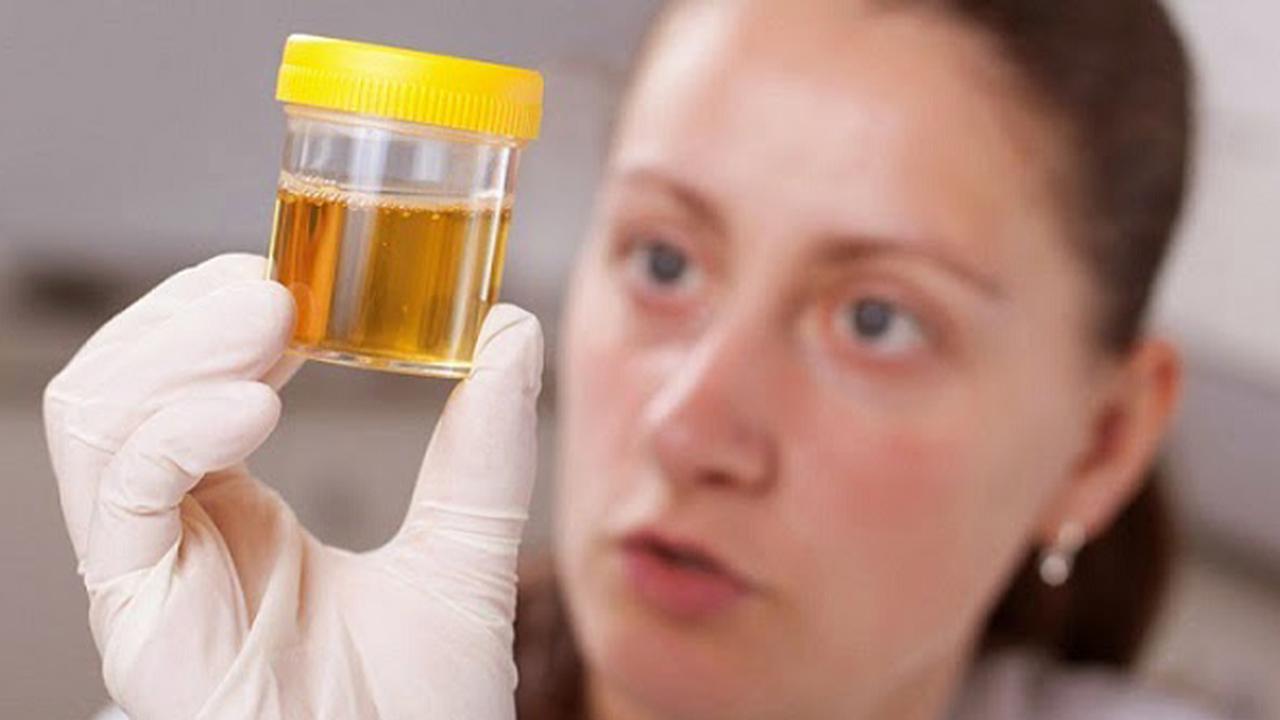 Benarkah Urin Mampu Bersihkan Jerawat?