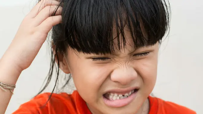 Cara alami menghilangkan kutu rambut ©shutterstock