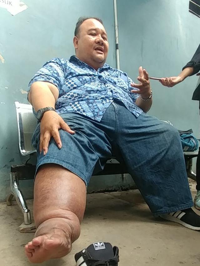 Rony Dozer Meninggal Dunia di Usia 46 Tahun, Sempat Sesak Napas