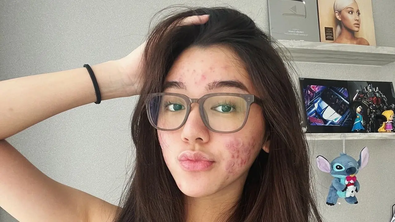 Potret Menawan Gabriella Eka Putri, Tampil Percaya Diri dengan Bare Face dan Berjerawat
