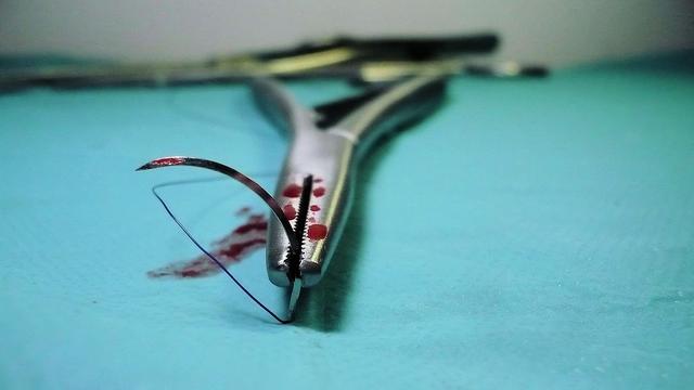 Benang Jahit Luka (Sumber: pixabay.com)