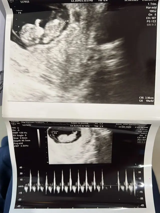 Marshel Widianto dan Cesen