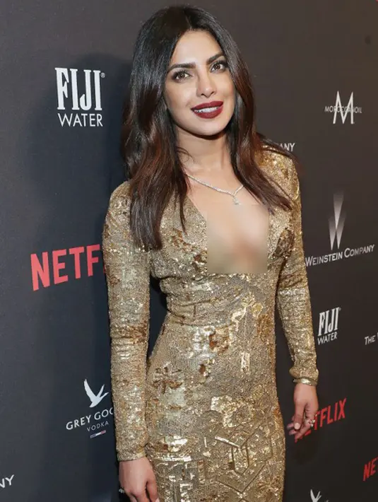 Melihat kehadiran Priyanka Chopra di akun Twitter tentu membuat senang para penggemarnya. Banyak kalimat doa yang diberikan untuk Priyanka agar dirinya bisa kembali ke dunia kariernya seperti sedia kala. (AFP/Bintang.com)