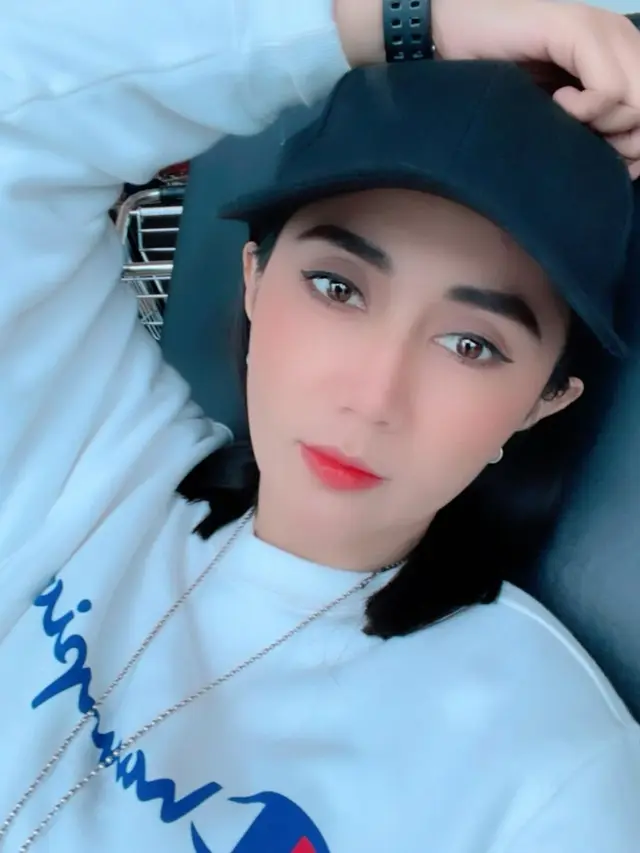 Sempat Prank Bunuh Diri, Ini 7 Potret Terbaru Aida Saskia Berjuang Lawan Kanker
