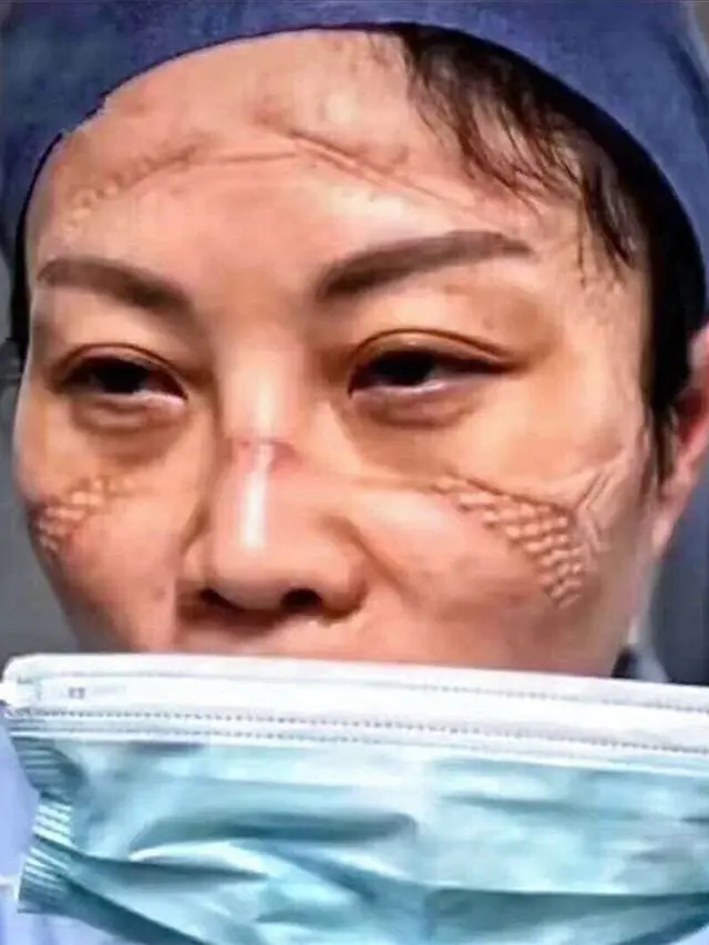 6 Potret Wajah Suster Rawat Pasien Virus Corona Ini Bikin Haru