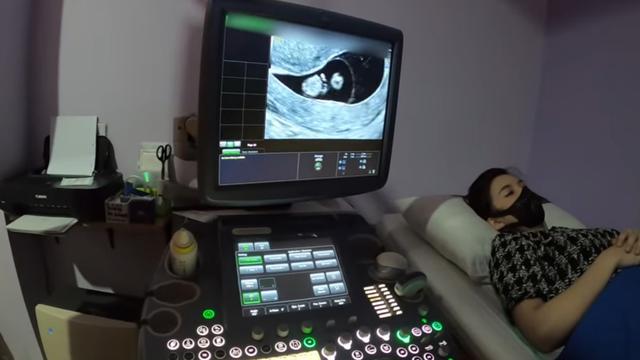 Bayinya Sehat, Ini 6 Momen Chelsea Olivia Periksa Kandungan