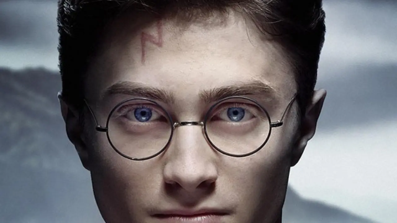 Berawal dari Luka, Anak Ini Berubah Jadi Harry Potter!