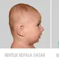 Ilustrasi: Bentuk Kepala Bayi