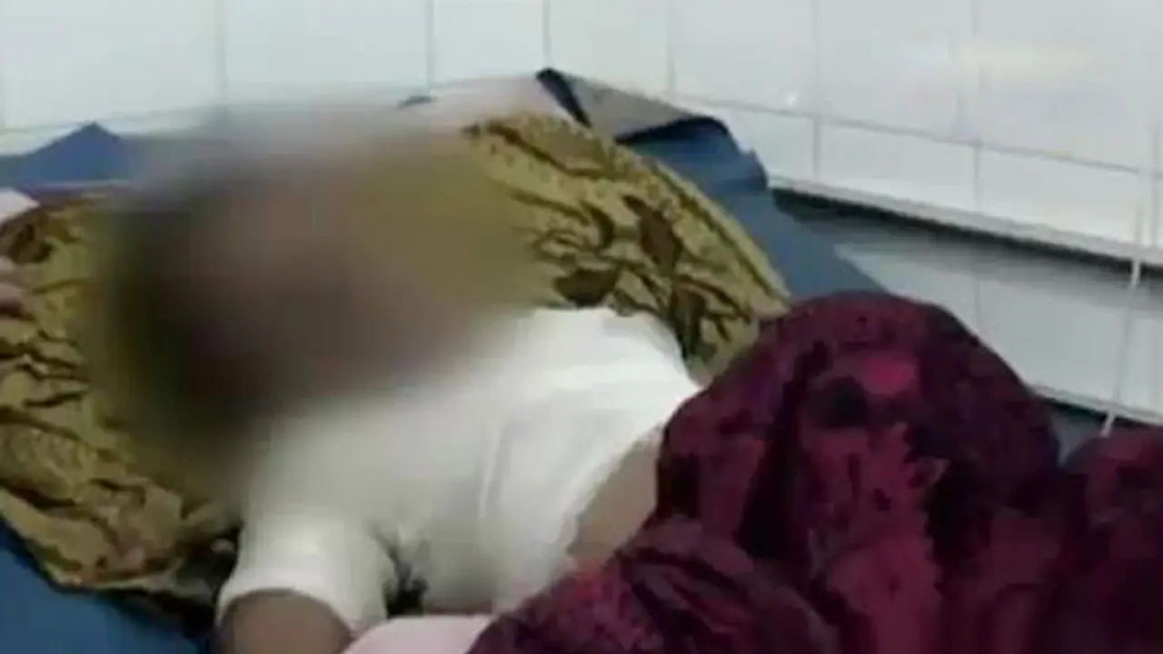 Balita Tersiram Minyak Panas