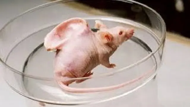 Tikus Bertelinga Manusia
