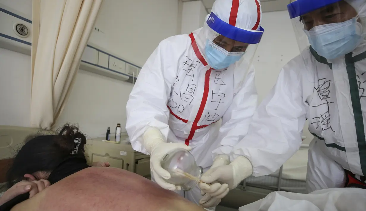 Seorang pasien yang terinfeksi virus corona COVID-19 menerima perawatan dengan teknik medis tradisional Tiongkok yang dikenal sebagai "bekam" di Rumah Sakit Palang Merah di Wuhan di provinsi Hubei China (11/3/2020). China melaporkan peningkatan kasus virus corona pada Maret 11. (AFP/STR)