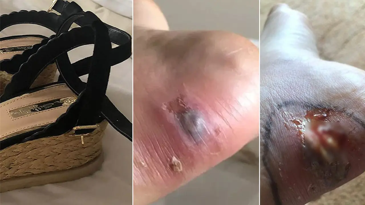 hampir meninggal karena heels