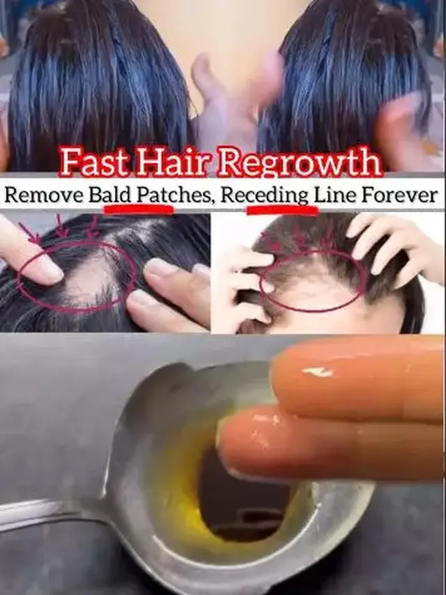 Cara Menggunakan Masker Minyak Jarak, Zaitun dan Cengkeh